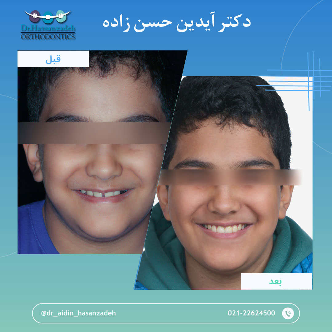 قبل و بعد از درمان