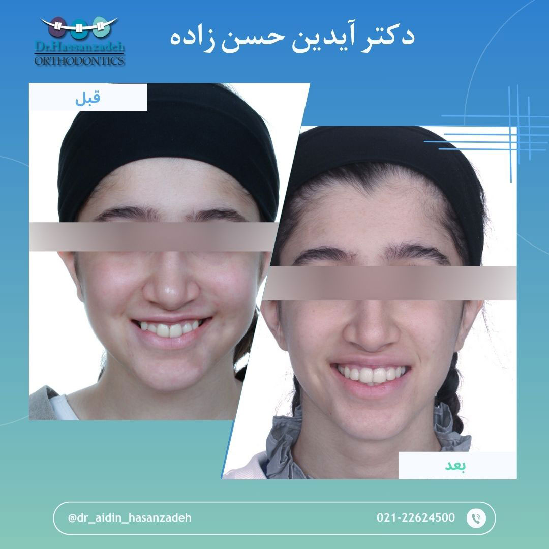 قبل و بعد از درمان