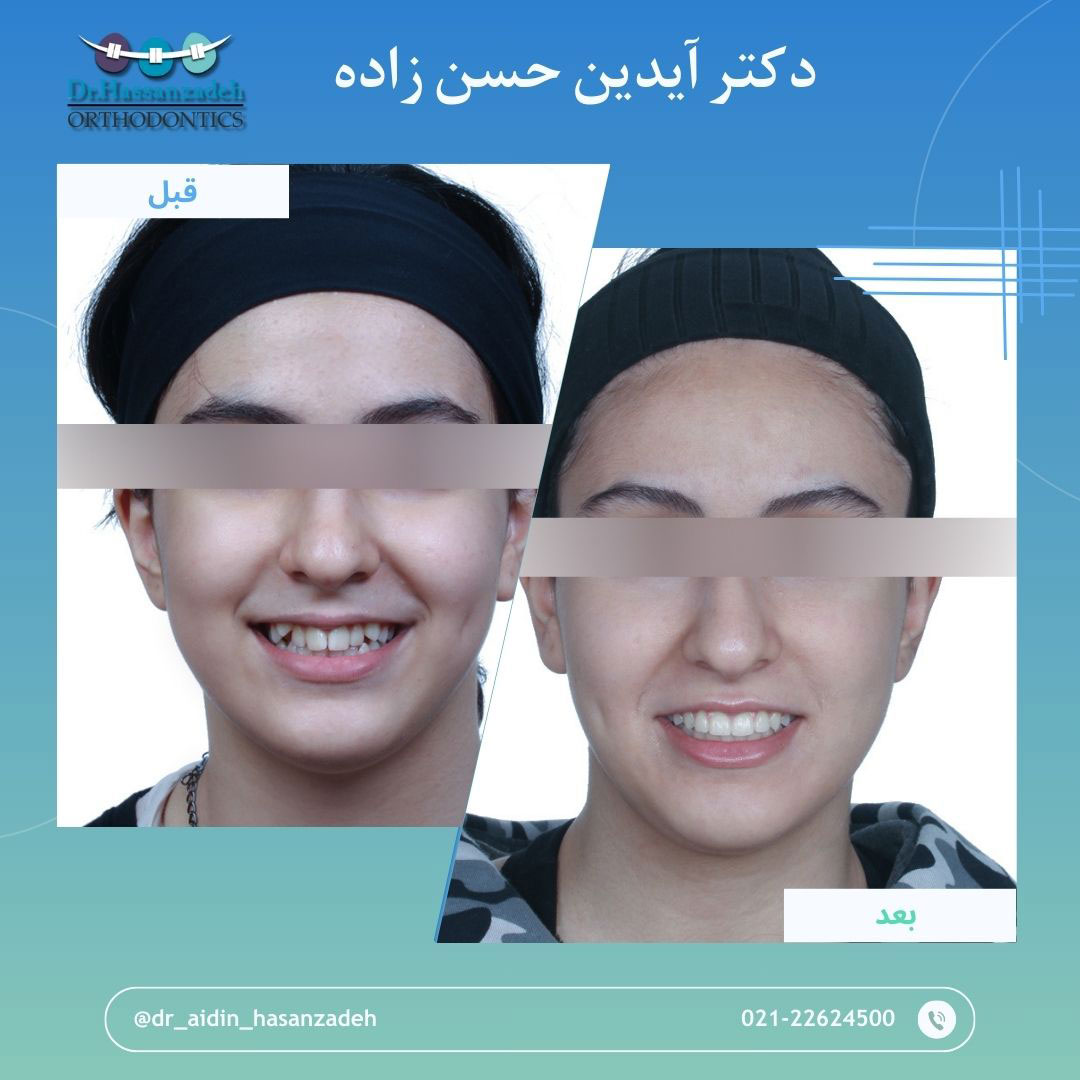 قبل و بعد از درمان