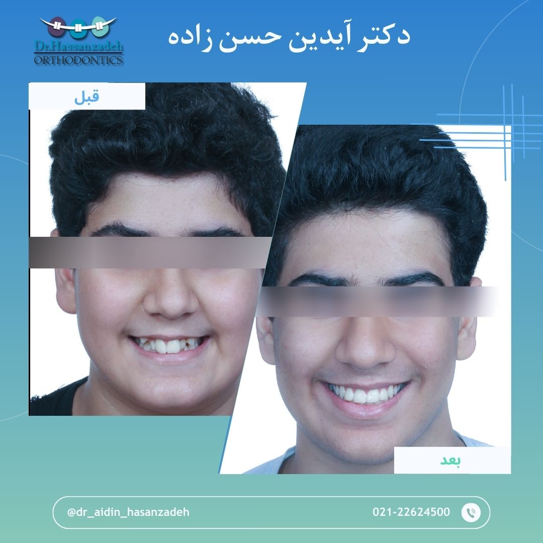 قبل و بعد از درمان