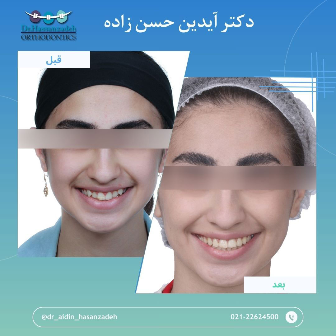 قبل و بعد از درمان