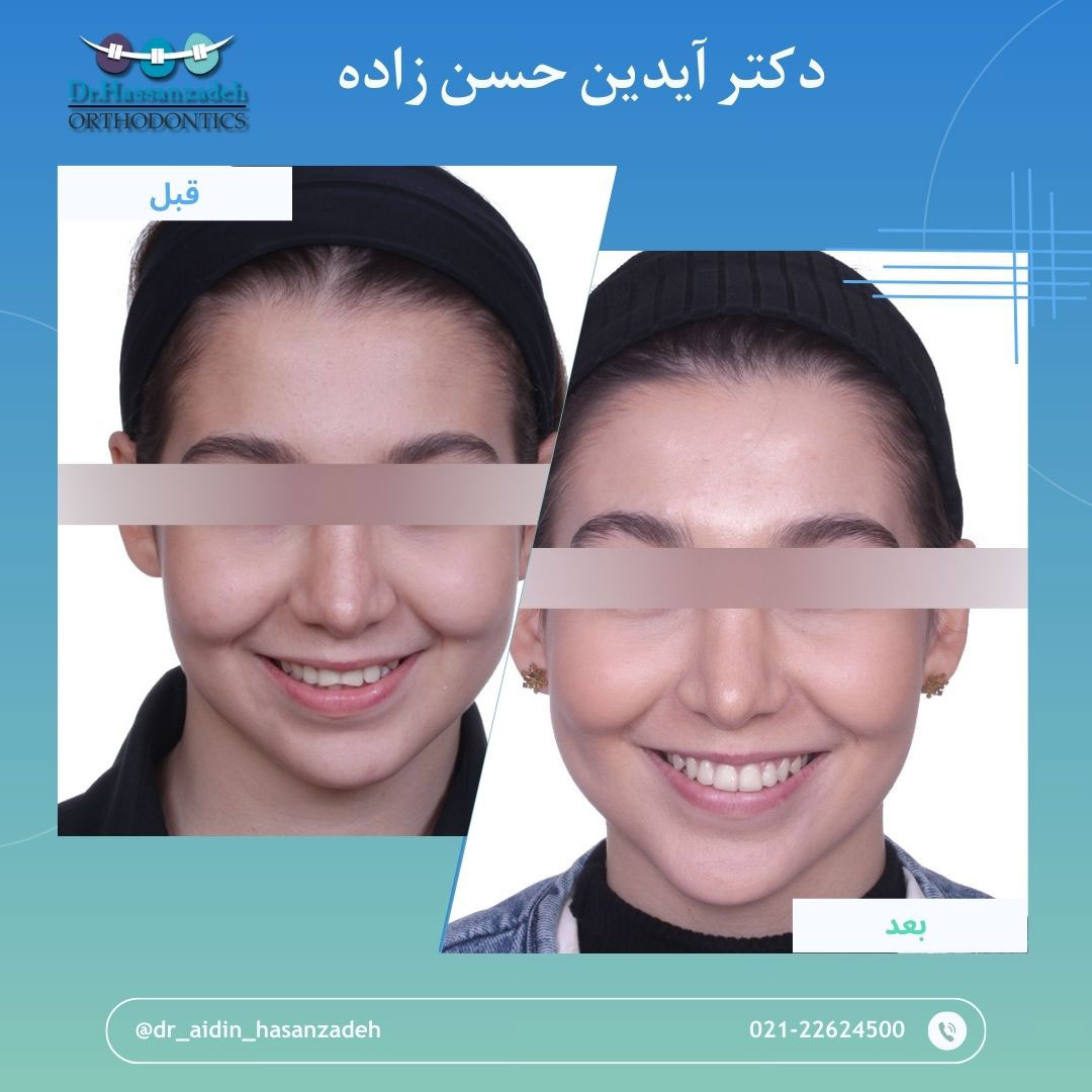 قبل و بعد از درمان