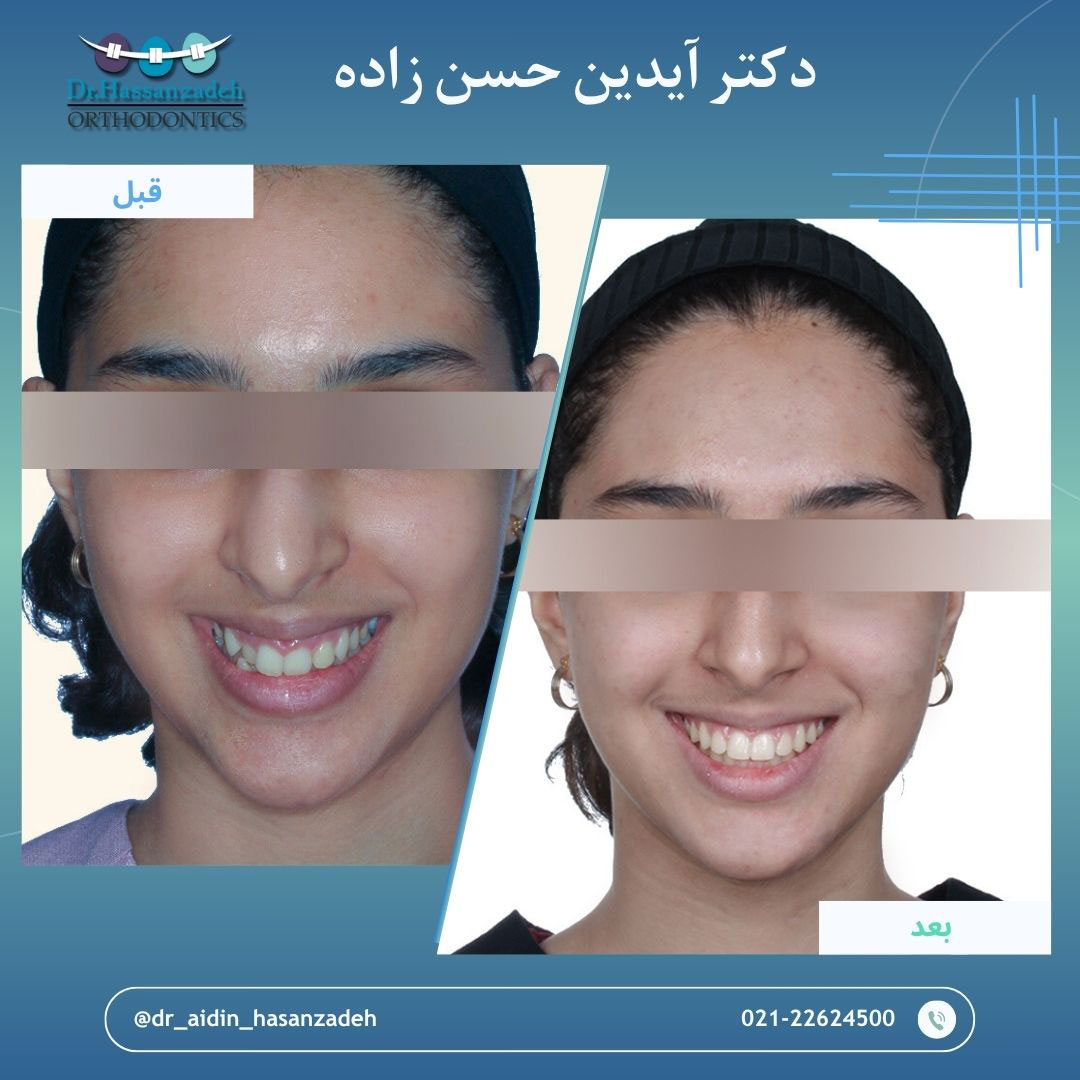 قبل و بعد از درمان