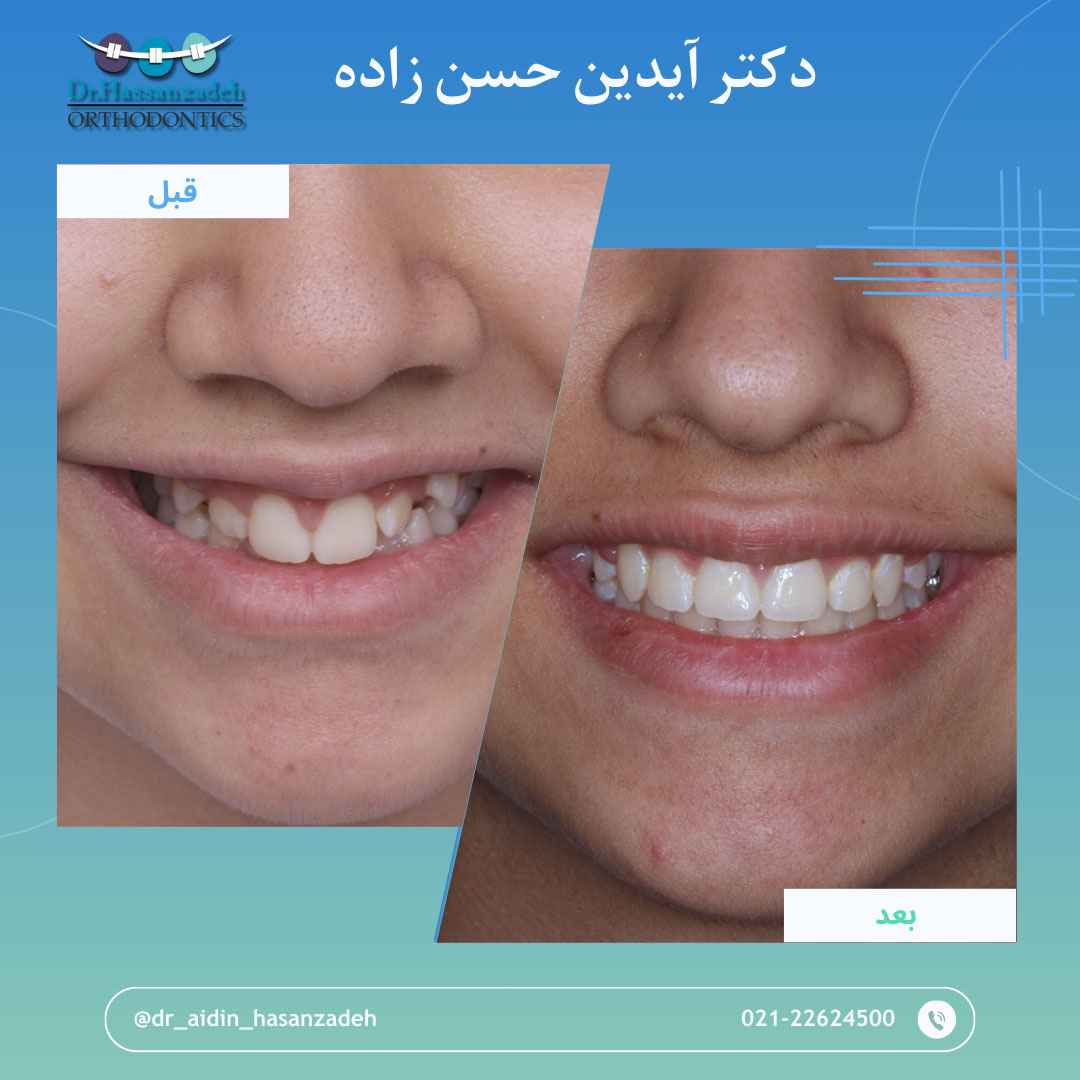 قبل و بعد از درمان