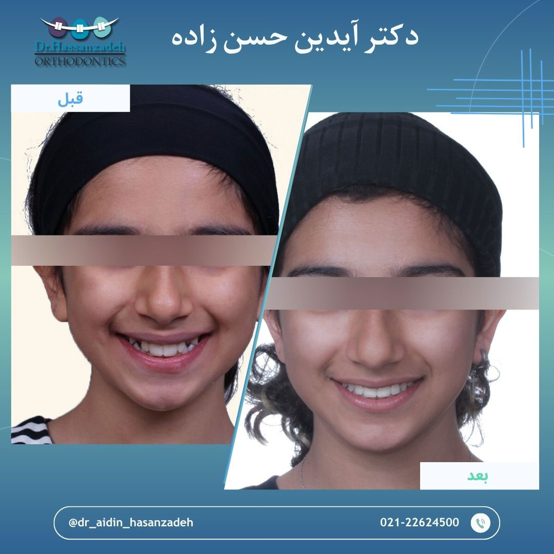 قبل و بعد از درمان