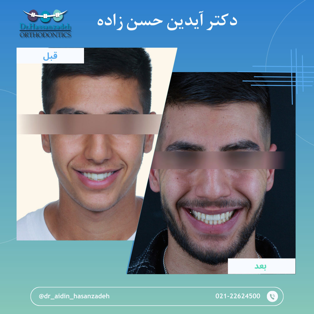 قبل و بعد از درمان