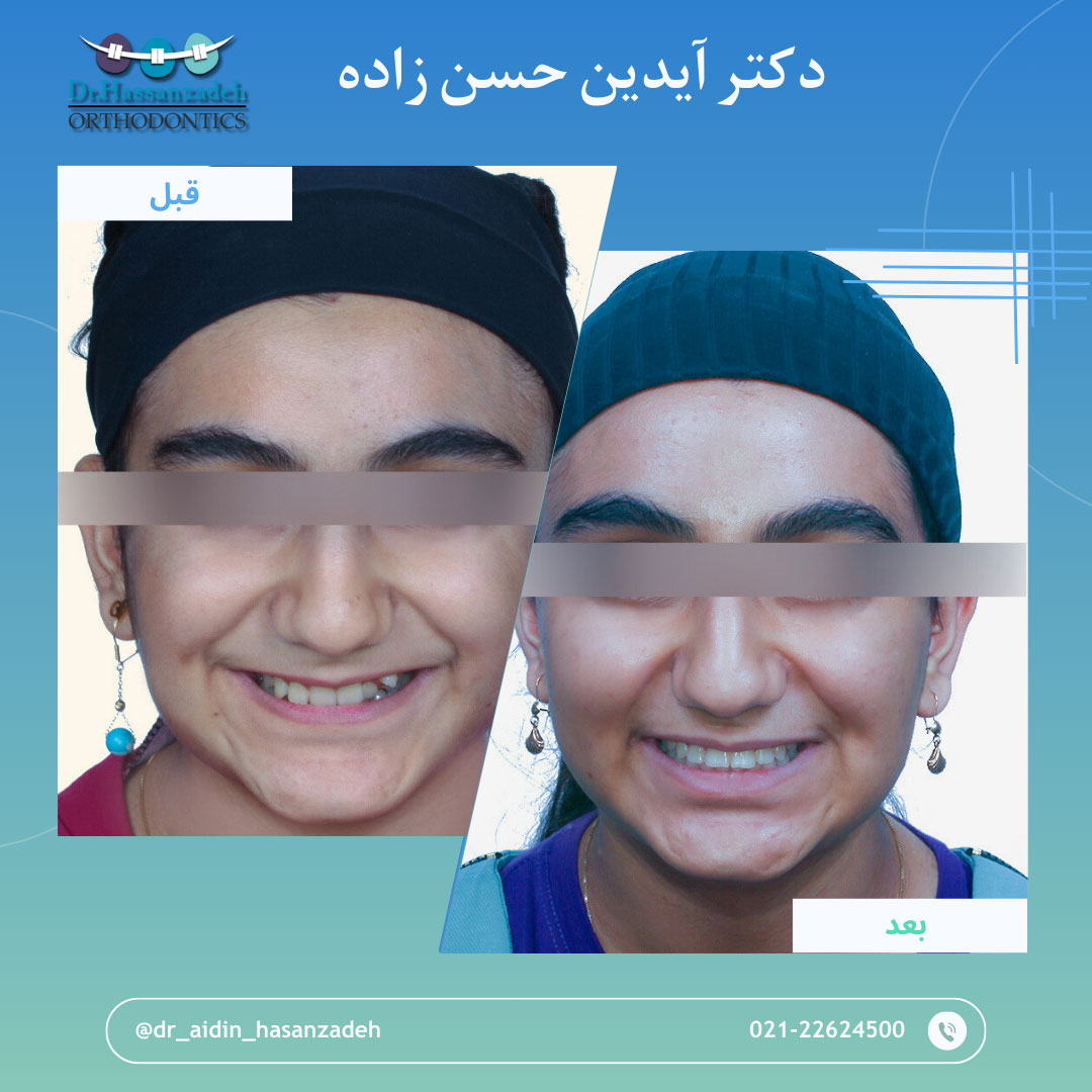 قبل و بعد از درمان