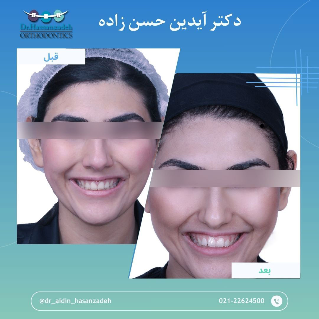 قبل و بعد از درمان