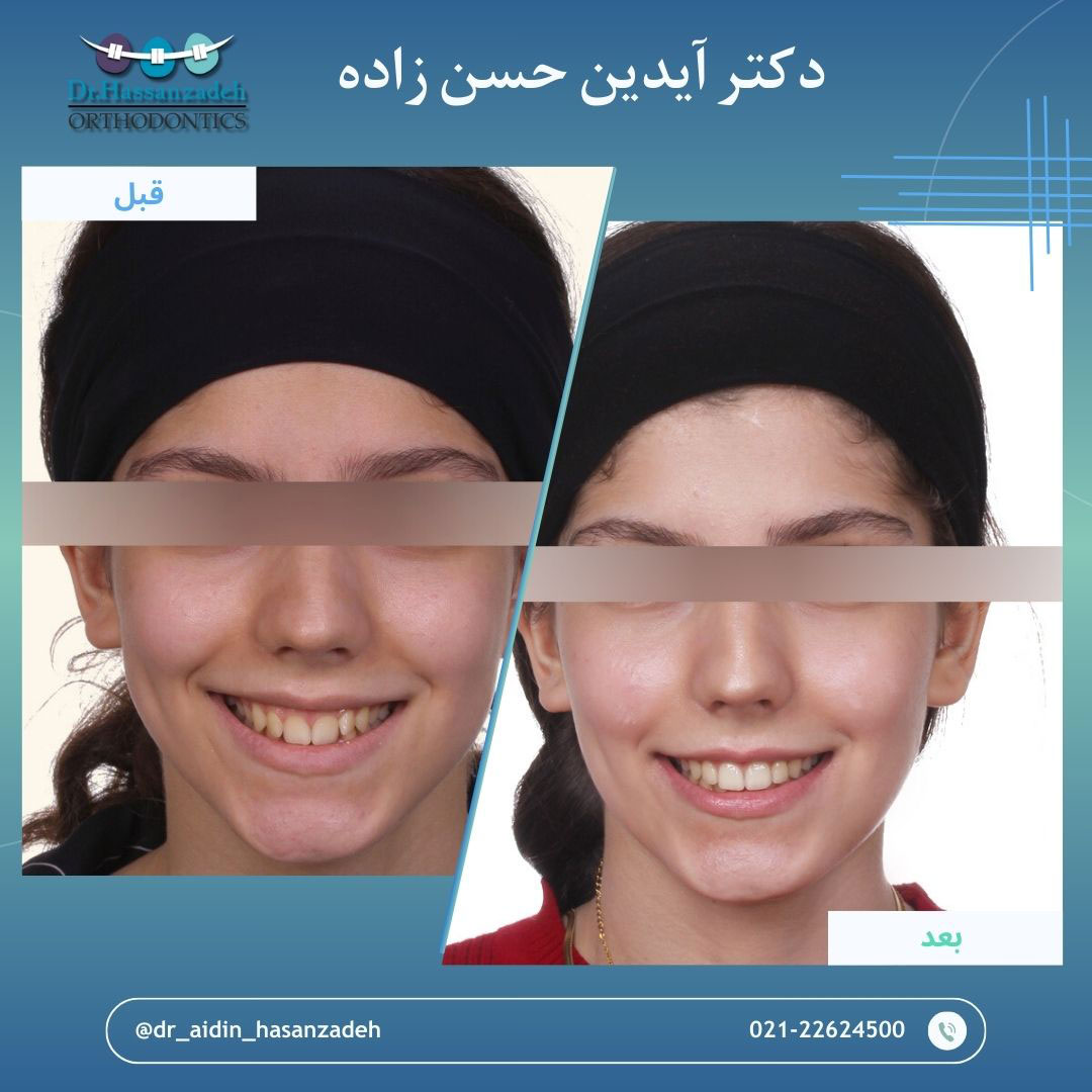 قبل و بعد از درمان