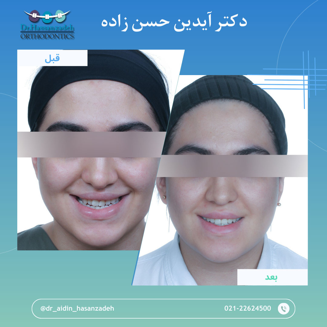 قبل و بعد از درمان