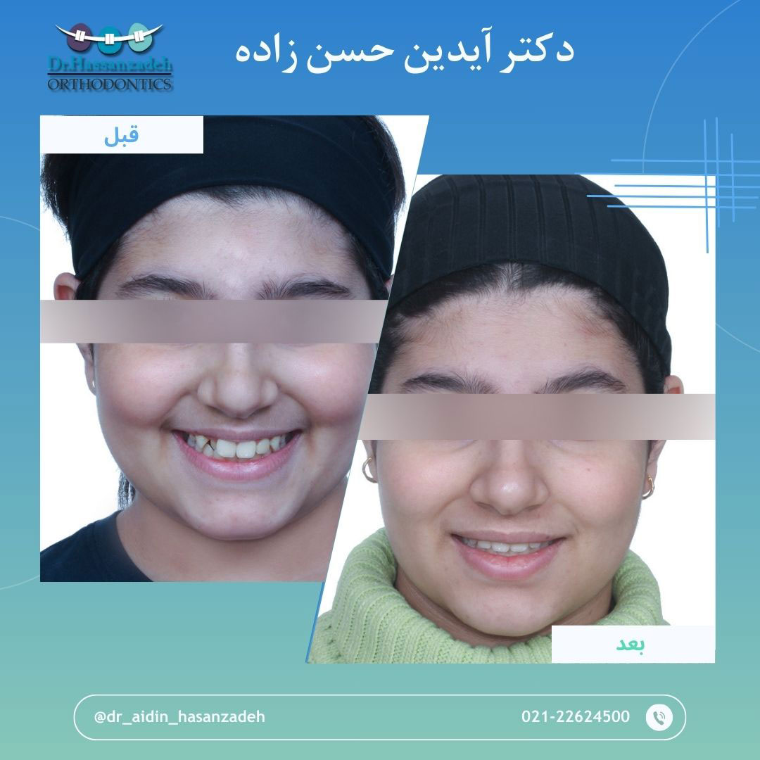 قبل و بعد از درمان