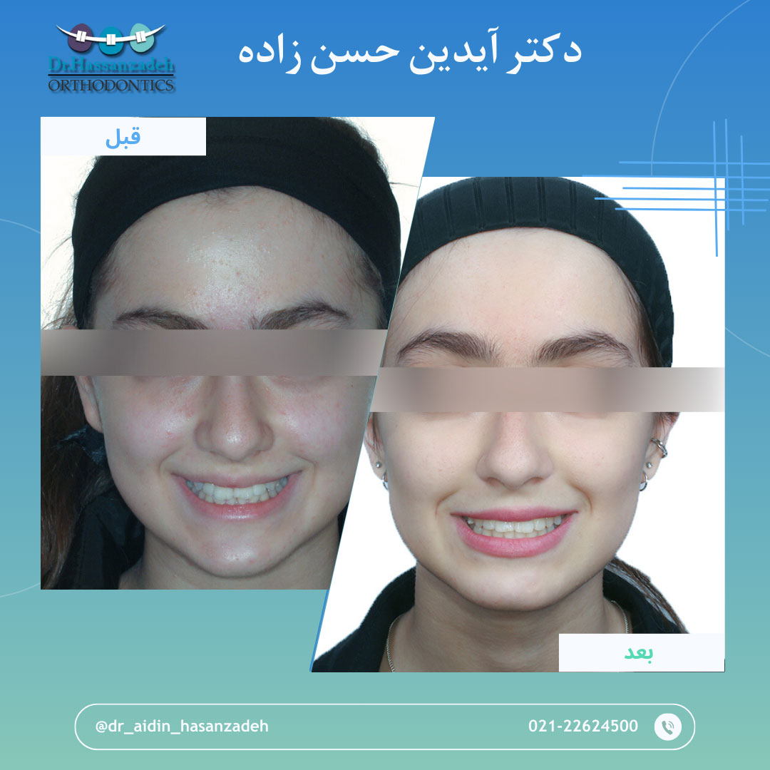 قبل و بعد از درمان