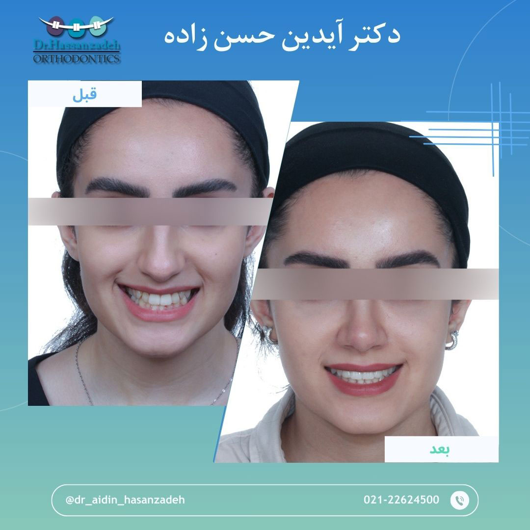 قبل و بعد از درمان