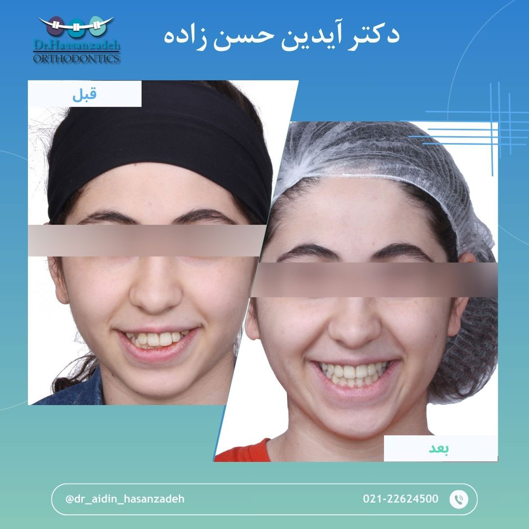 قبل و بعد از درمان